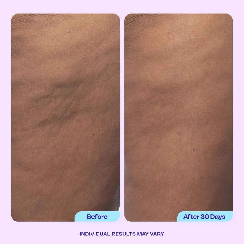 Firming Butt & Thigh Cream