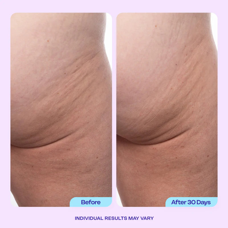 Firming Butt & Thigh Cream